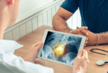 Centre For Orthopedic Surgery And Its Impact On Modern Healthcare