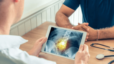 Centre For Orthopedic Surgery And Its Impact On Modern Healthcare